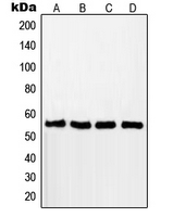 RAD18 Antibody - Western blot analysis of RAD18 expression in MCF7 (A); A549 (B); Jurkat (C); HCT116 (D) whole cell lysates.