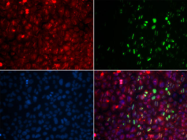 RAD18 Antibody - Immunofluorescence analysis of GFP-RNF168 trangenic U2OS cells.