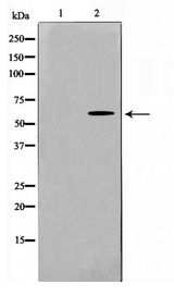 RAD18 Antibody - Western blot of LOVO cell lysate using RAD18 Antibody