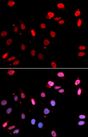 RAD18 Antibody - Immunofluorescence analysis of U2OS cells using RAD18 antibody. Blue: DAPI for nuclear staining.