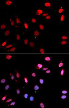 RAD18 Antibody - Immunofluorescence analysis of U2OS cells using RAD18 antibody. Blue: DAPI for nuclear staining.