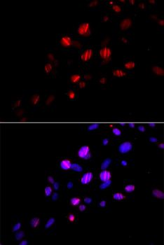 RAD18 Antibody - Immunofluorescence analysis of U2OS cells using RAD18 antibody. Blue: DAPI for nuclear staining. DNA damage by a UV-A laser.