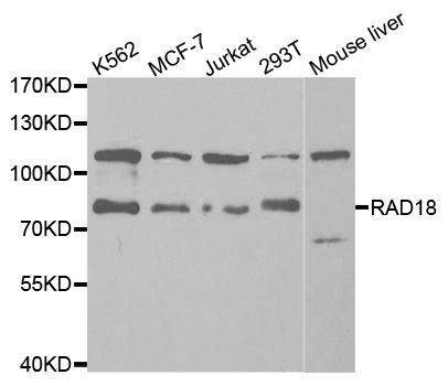RAD18 Antibody - Western blot analysis of extracts of various cell lines, using RAD18 antibody at 1:1000 dilution. The secondary antibody used was an HRP Goat Anti-Rabbit IgG (H+L) at 1:10000 dilution. Lysates were loaded 25ug per lane and 3% nonfat dry milk in TBST was used for blocking. An ECL Kit was used for detection and the exposure time was 120s.
