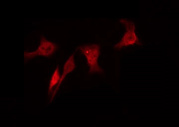 RAD18 Antibody - Staining LOVO cells by IF/ICC. The samples were fixed with PFA and permeabilized in 0.1% Triton X-100, then blocked in 10% serum for 45 min at 25°C. The primary antibody was diluted at 1:200 and incubated with the sample for 1 hour at 37°C. An Alexa Fluor 594 conjugated goat anti-rabbit IgG (H+L) Ab, diluted at 1/600, was used as the secondary antibody.