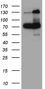 RAD21 Antibody - HEK293T cells were transfected with the pCMV6-ENTRY control. (Left lane) or pCMV6-ENTRY RAD21. (Right lane) cDNA for 48 hrs and lysed. Equivalent amounts of cell lysates. (5 ug per lane) were separated by SDS-PAGE and immunoblotted with anti-RAD21. (1:2000)