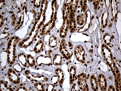 RAD21 Antibody - Immunohistochemical staining of paraffin-embedded Human Kidney tissue within the normal limits using anti-RAD21 mouse monoclonal antibody. (Heat-induced epitope retrieval by 1mM EDTA in 10mM Tris buffer. (pH8.5) at 120°C for 3 min. (1:2000)