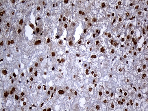 RAD21 Antibody - Immunohistochemical staining of paraffin-embedded Human liver tissue within the normal limits using anti-RAD21 mouse monoclonal antibody. (Heat-induced epitope retrieval by 1mM EDTA in 10mM Tris buffer. (pH8.5) at 120°C for 3 min. (1:2000)