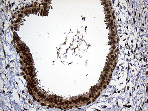RAD21 Antibody - Immunohistochemical staining of paraffin-embedded Human breast tissue within the normal limits using anti-RAD21 mouse monoclonal antibody. (Heat-induced epitope retrieval by 1mM EDTA in 10mM Tris buffer. (pH8.5) at 120°C for 3 min. (1:2000)