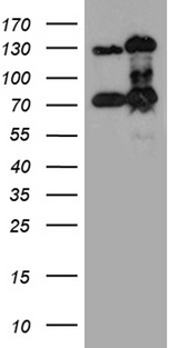 RAD21 Antibody - HEK293T cells were transfected with the pCMV6-ENTRY control. (Left lane) or pCMV6-ENTRY RAD21. (Right lane) cDNA for 48 hrs and lysed. Equivalent amounts of cell lysates. (5 ug per lane) were separated by SDS-PAGE and immunoblotted with anti-RAD21. (1:2000)