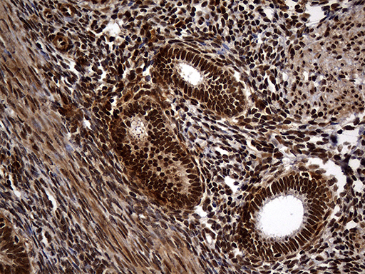 RAD21 Antibody - Immunohistochemical staining of paraffin-embedded Human endometrium tissue within the normal limits using anti-RAD21 mouse monoclonal antibody. (Heat-induced epitope retrieval by 1mM EDTA in 10mM Tris buffer. (pH8.5) at 120°C for 3 min. (1:2000)
