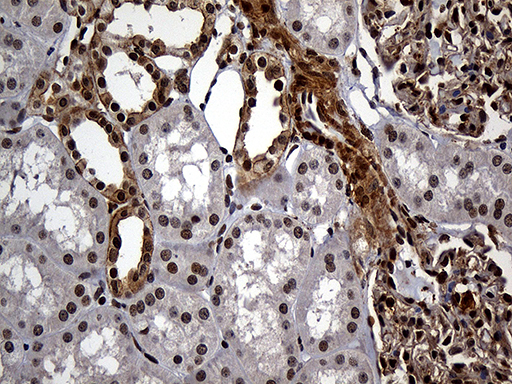 RAD21 Antibody - Immunohistochemical staining of paraffin-embedded Human Kidney tissue within the normal limits using anti-RAD21 mouse monoclonal antibody. (Heat-induced epitope retrieval by 1mM EDTA in 10mM Tris buffer. (pH8.5) at 120°C for 3 min. (1:2000)
