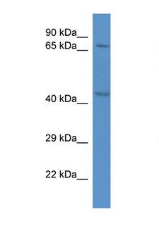 RAD21 Antibody - RAD21 antibody Western blot of Rat Heart lysate. Antibody concentration 1 ug/ml. This image was taken for the unconjugated form of this product. Other forms have not been tested.