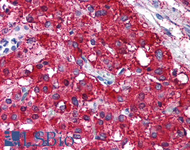 RAD21 Antibody - Anti-RAD21 antibody IHC of human adrenal medulla. Immunohistochemistry of formalin-fixed, paraffin-embedded tissue after heat-induced antigen retrieval. Antibody concentration 20 ug/ml. This image was taken for the unconjugated form of this product. Other forms have not been tested.