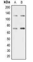 RAD21 Antibody - Western blot analysis of RAD21 expression in Jurkat (A); A431 (B) whole cell lysates.