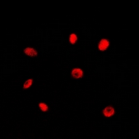 RAD21 Antibody - Immunofluorescent analysis of RAD21 staining in Jurkat cells. Formalin-fixed cells were permeabilized with 0.1% Triton X-100 in TBS for 5-10 minutes and blocked with 3% BSA-PBS for 30 minutes at room temperature. Cells were probed with the primary antibody in 3% BSA-PBS and incubated overnight at 4 deg C in a humidified chamber. Cells were washed with PBST and incubated with a DyLight 594-conjugated secondary antibody (red) in PBS at room temperature in the dark. DAPI was used to stain the cell nuclei (blue).