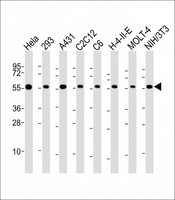 RAD21 Antibody - All lanes: Anti-RAD21 Antibody (C-Term) at 1:2000 dilution Lane 1: Hela whole cell lysate Lane 2: 293 whole cell lysate Lane 3: A431 whole cell lysate Lane 4: C2C12 whole cell lysate Lane 5: C6 whole cell lysate Lane 6: H-4-II-E whole cell lysate Lane 7: MOLT-4 whole cell lysate Lane 8: NIH/3T3 whole cell lysate Lysates/proteins at 20 µg per lane. Secondary Goat Anti-Rabbit IgG, (H+L), Peroxidase conjugated at 1/10000 dilution. Predicted band size: 72 kDa Blocking/Dilution buffer: 5% NFDM/TBST.