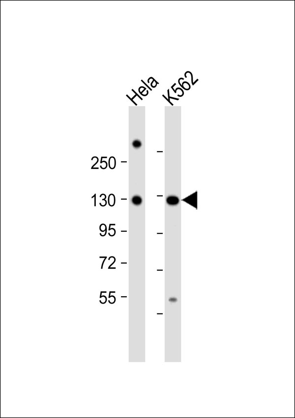 RAD21 Antibody - All lanes: Anti-RAD21 Antibody at 1:1000 dilution. Lane 1: HeLa whole cell lysate. Lane 2: K562 whole cell lysate Lysates/proteins at 20 ug per lane. Secondary Goat Anti-Rabbit IgG, (H+L), Peroxidase conjugated at 1:10000 dilution. Predicted band size: 72 kDa. Blocking/Dilution buffer: 5% NFDM/TBST.