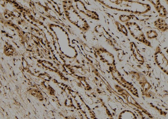 RAD21 Antibody - 1:100 staining human kidney tissue by IHC-P. The sample was formaldehyde fixed and a heat mediated antigen retrieval step in citrate buffer was performed. The sample was then blocked and incubated with the antibody for 1.5 hours at 22°C. An HRP conjugated goat anti-rabbit antibody was used as the secondary.