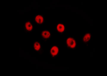 RAD21 Antibody - Staining HeLa cells by IF/ICC. The samples were fixed with PFA and permeabilized in 0.1% Triton X-100, then blocked in 10% serum for 45 min at 25°C. The primary antibody was diluted at 1:200 and incubated with the sample for 1 hour at 37°C. An Alexa Fluor 594 conjugated goat anti-rabbit IgG (H+L) antibody, diluted at 1/600, was used as secondary antibody.
