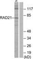 RAD21 Antibody - Western blot analysis of extracts from Jurkat cells, using RAD21 antibody.