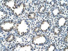 RAD23A / HHR23A Antibody - RAD23A / HHR23A antibody ARP42210_T100-NP_005044-RAD23A(RAD23 homolog A (S. cerevisiae)) Antibody was used in IHC to stain formalin-fixed, paraffin-embedded human lung.  This image was taken for the unconjugated form of this product. Other forms have not been tested.