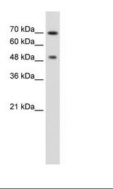 RAD23A / HHR23A Antibody - Jurkat Cell Lysate.  This image was taken for the unconjugated form of this product. Other forms have not been tested.