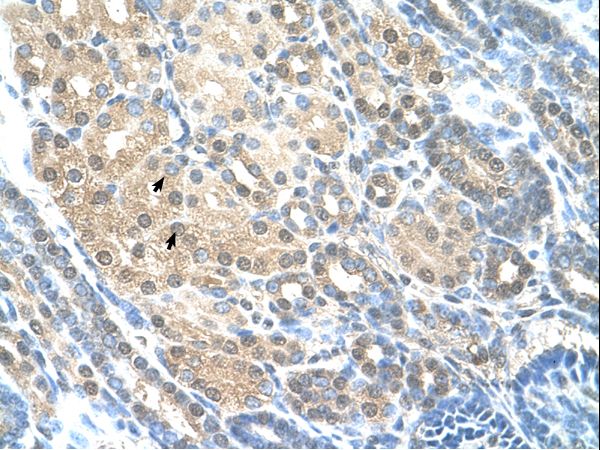 RAD23A / HHR23A Antibody - RAD23A / HHR23A antibody ARP42211_T100-NP_005044-RAD23A(RAD23 homolog A (S. cerevisiae)) Antibody was used in IHC to stain formalin-fixed, paraffin-embedded human kidney.  This image was taken for the unconjugated form of this product. Other forms have not been tested.
