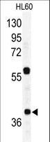 RAD23A / HHR23A Antibody - Western blot of RAD23A Antibody in HL60 cell line lysates (35 ug/lane). RAD23A (arrow) was detected using the purified antibody.