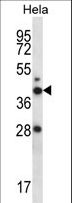 RAD23A / HHR23A Antibody - RAD23A Antibody western blot of HeLa cell line lysates (35 ug/lane). The RAD23A antibody detected the RAD23A protein (arrow).