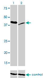 RAD23A / HHR23A Antibody - Western blot analysis of RAD23A over-expressed 293 cell line, cotransfected with RAD23A Validated Chimera RNAi (Lane 2) or non-transfected control (Lane 1). Blot probed with RAD23A monoclonal antibody (M01), clone 3C12 . GAPDH ( 36.1 kDa ) used as specificity and loading control.