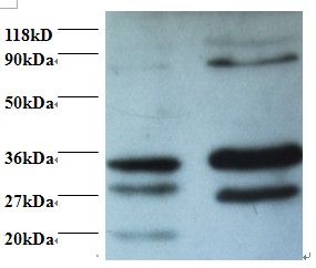 RAD23A / HHR23A Antibody - Western blot of UV excision repair protein RAD23 homolog A antibody at 2 ug/ml. Lane 1: EC109 whole cell lysate. Lane 2: 293T whole cell lysate. Secondary: Goat polyclonal to Rabbit IgG at 1:15000 dilution. Predicted band size: 40 kDa. Observed band size: 27 kDa Additional bands at: 35 kDaã€80 kDa. We are unsure as to the identity of this extra bands.  This image was taken for the unconjugated form of this product. Other forms have not been tested.