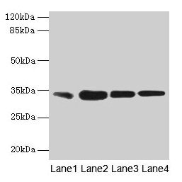 RAD23A / HHR23A Antibody - Western blot All lanes: UV excision repair protein RAD23 homolog A antibody at 2µg/ml Lane 1: EC109 whole cell lysate Lane 2: 293T whole cell lysate Secondary Goat polyclonal to rabbit IgG at 1/15000 dilution Predicted band size: 40, 34 kDa Observed band size: 40 kDa