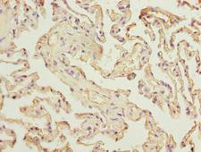 RAD23A / HHR23A Antibody - Immunohistochemistry of paraffin-embedded human lung tissue using RAD23A Antibody at dilution of 1:100