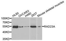 RAD23A / HHR23A Antibody - Western blot analysis of extracts of various cells.
