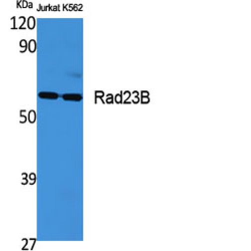 RAD23B / HR23B Antibody - Western blot of Rad23B antibody