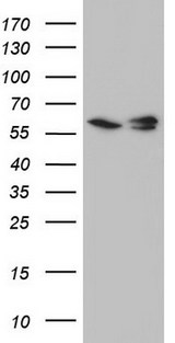 RAD23B / HR23B Antibody - HEK293T cells were transfected with the pCMV6-ENTRY control. (Left lane) or pCMV6-ENTRY RAD23B. (Right lane) cDNA for 48 hrs and lysed. Equivalent amounts of cell lysates. (5 ug per lane) were separated by SDS-PAGE and immunoblotted with anti-RAD23B.