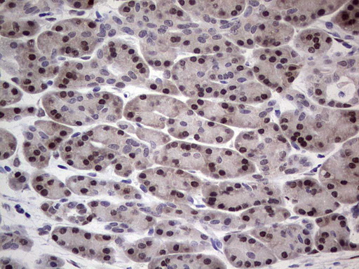 RAD23B / HR23B Antibody - Immunohistochemical staining of paraffin-embedded Human pancreas tissue within the normal limits using anti-RAD23B mouse monoclonal antibody. (Heat-induced epitope retrieval by 1 mM EDTA in 10mM Tris, pH8.5, 120C for 3min,