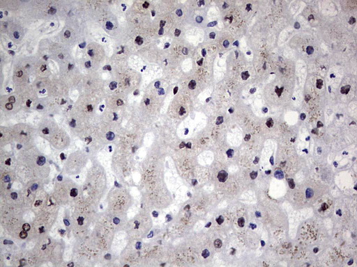 RAD23B / HR23B Antibody - Immunohistochemical staining of paraffin-embedded Human liver tissue within the normal limits using anti-RAD23B mouse monoclonal antibody. (Heat-induced epitope retrieval by 1 mM EDTA in 10mM Tris, pH8.5, 120C for 3min,