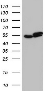 RAD23B / HR23B Antibody - HEK293T cells were transfected with the pCMV6-ENTRY control. (Left lane) or pCMV6-ENTRY RAD23B. (Right lane) cDNA for 48 hrs and lysed. Equivalent amounts of cell lysates. (5 ug per lane) were separated by SDS-PAGE and immunoblotted with anti-RAD23B.