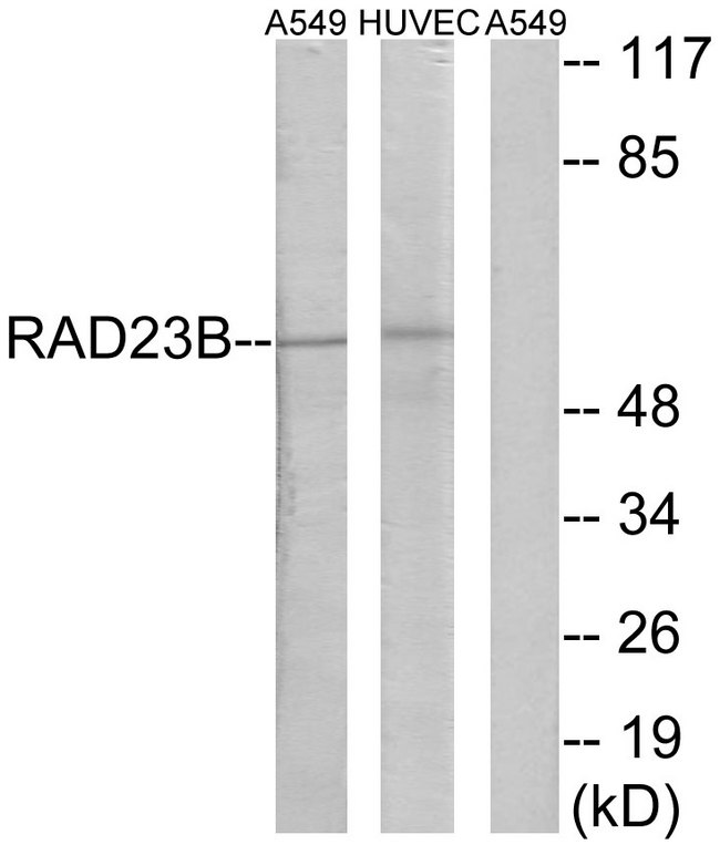 RAD23B / HR23B Antibody - Western blot analysis of lysates from A549 and HUVEC cells, using RAD23B Antibody. The lane on the right is blocked with the synthesized peptide.