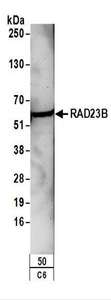 RAD23B / HR23B Antibody - Detection of Rat RAD23B by Western Blot. Samples: Whole cell lysate (50 ug) from C6 cells. Antibodies: Affinity purified rabbit anti-RAD23B antibody used for WB at 0.2 ug/ml. Detection: Chemiluminescence with an exposure time of 3 minutes.