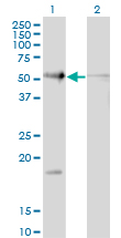 RAD23B / HR23B Antibody - Western blot of RAD23B expression in transfected 293T cell line by RAD23B monoclonal antibody (M10), clone 3H7.