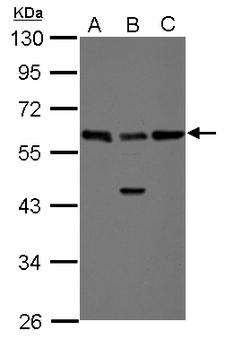 RAD23B / HR23B Antibody - Sample (30 ug of whole cell lysate) A: A431 B: Jurkat C: Raji 10% SDS PAGE RAD23B antibody diluted at 1:1000