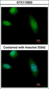 RAD23B / HR23B Antibody - Immunofluorescence of paraformaldehyde-fixed HeLa, using RAD23B antibody at 1:500 dilution.