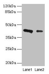 RAD23B / HR23B Antibody - Western blot All lanes: RAD23B antibody at 2µg/ml Lane 1: Jurkat cells Lane 2: 293T cells Lane 3: A431 cells Lane 4: MCF-7 cells Secondary Goat polyclonal to rabbit IgG at 1/10000 dilution Predicted band size: 44, 36 kDa Observed band size: 44 kDa