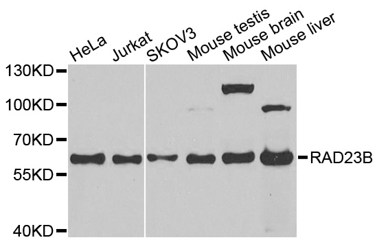 RAD23B / HR23B Antibody - Western blot analysis of extracts of various cell lines, using RAD23B antibody at 1:1000 dilution. The secondary antibody used was an HRP Goat Anti-Rabbit IgG (H+L) at 1:10000 dilution. Lysates were loaded 25ug per lane and 3% nonfat dry milk in TBST was used for blocking. An ECL Kit was used for detection and the exposure time was 90s.