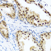 RAD23B / HR23B Antibody - Immunohistochemistry of paraffin-embedded human prostate using RAD23B antibodyat dilution of 1:100 (40x lens).