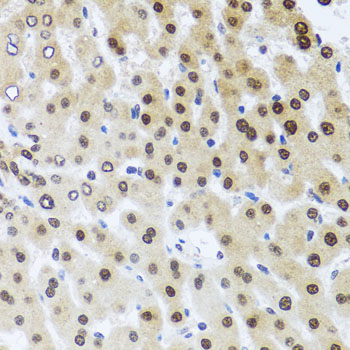 RAD23B / HR23B Antibody - Immunohistochemistry of paraffin-embedded human liver injury using RAD23B antibodyat dilution of 1:100 (40x lens).