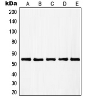 RAD23B / HR23B Antibody - Western blot analysis of RAD23B expression in A431 (A); HUVEC (B); HEK293 (C); HeLa (D); HT29 (E) whole cell lysates.