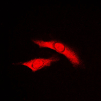 RAD23B / HR23B Antibody - Immunofluorescent analysis of RAD23B staining in HUVEC cells. Formalin-fixed cells were permeabilized with 0.1% Triton X-100 in TBS for 5-10 minutes and blocked with 3% BSA-PBS for 30 minutes at room temperature. Cells were probed with the primary antibody in 3% BSA-PBS and incubated overnight at 4 C in a humidified chamber. Cells were washed with PBST and incubated with a DyLight 594-conjugated secondary antibody (red) in PBS at room temperature in the dark. DAPI was used to stain the cell nuclei (blue).